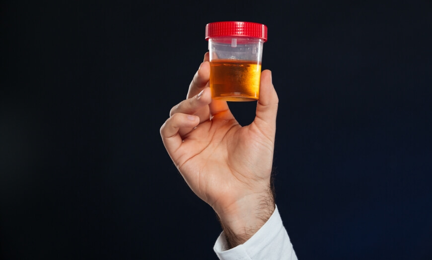 Ardência ao urinar: o que pode ser?